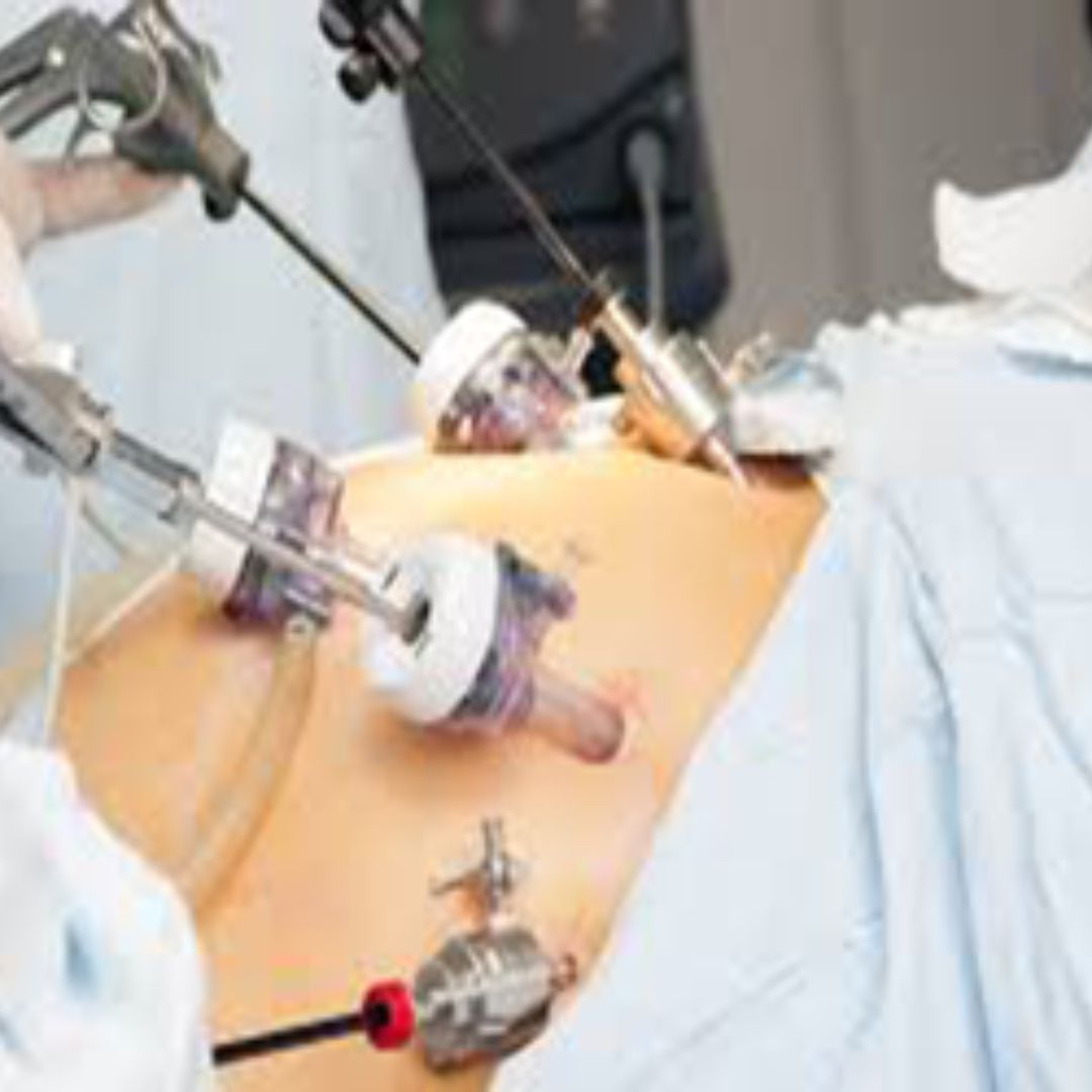 Laparoscopic Surgery: Revolutionizing Healthcare in Nashik with Dr. Swapnil Parakh