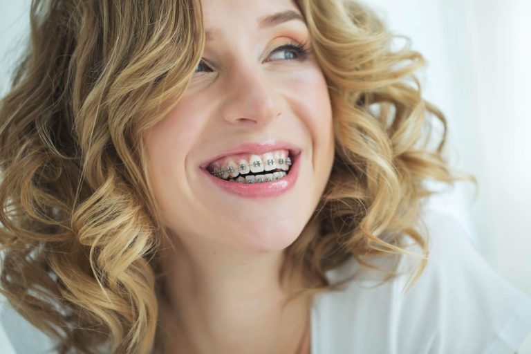 Transform Your Smile: The Ultimate Guide To Dental Braces Treatment In Thane With Smile Wellness