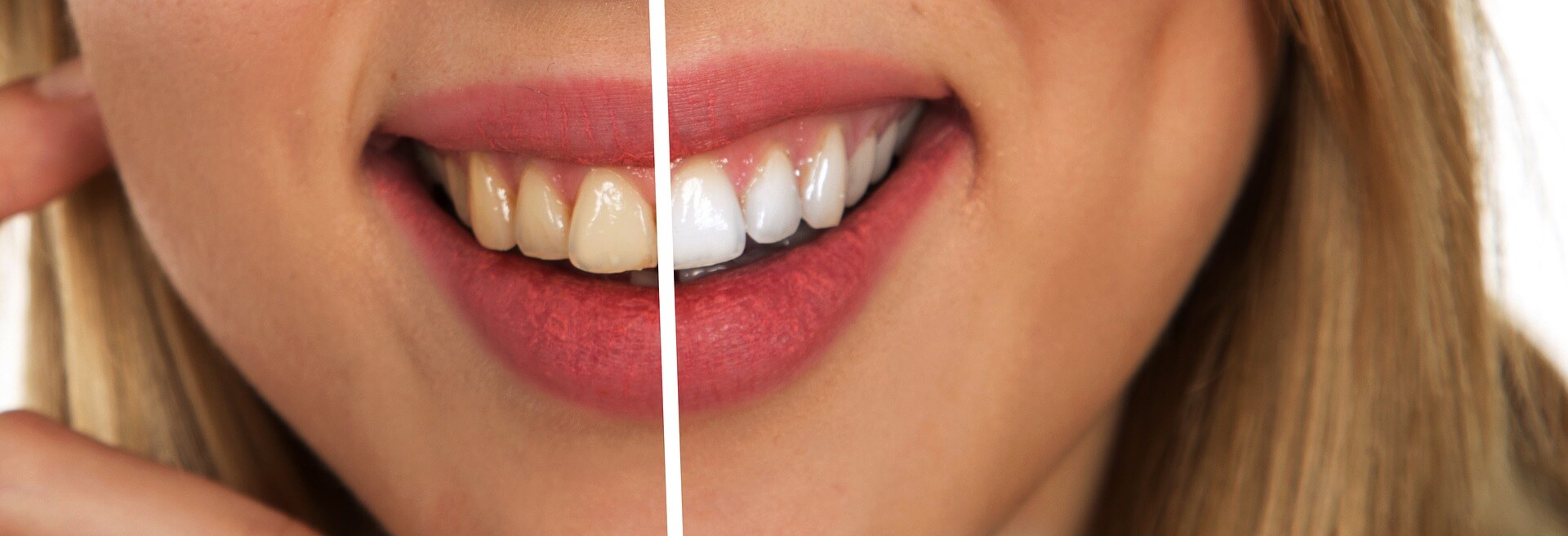 FROM FLAWS TO FLAWLESS: HOW COSMETIC GUM SURGERY IS RESHAPING SMILES IN THANE