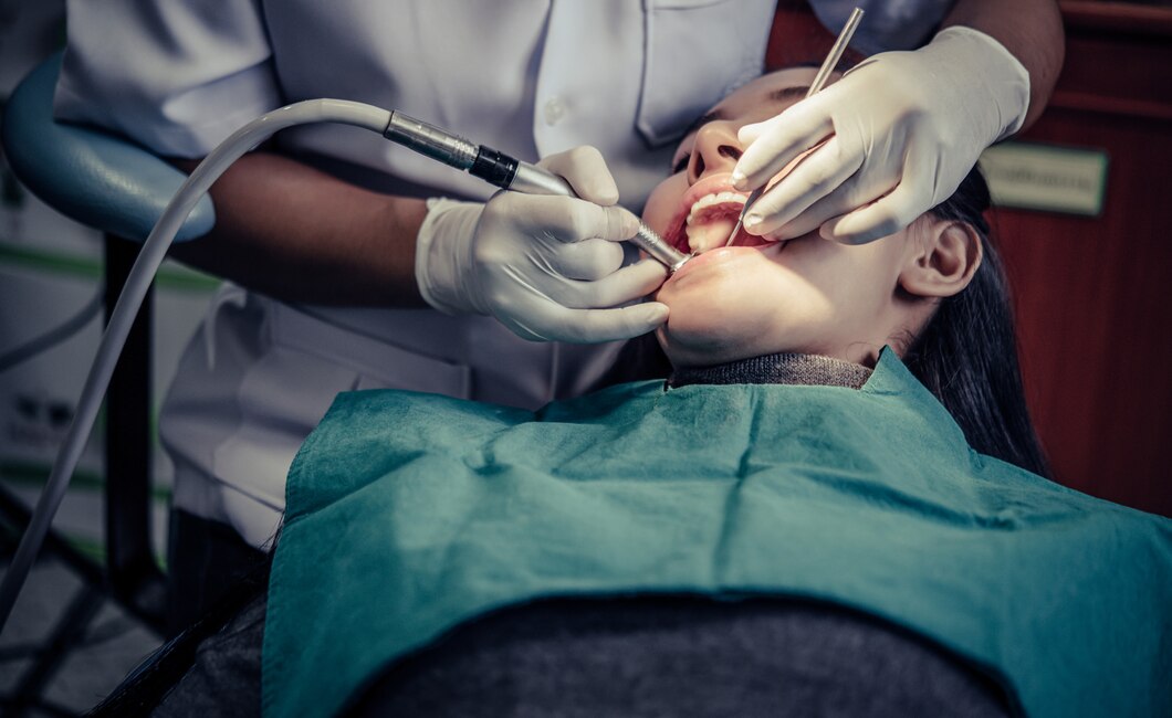 4 Reasons Why You Should Choose Dental Implants