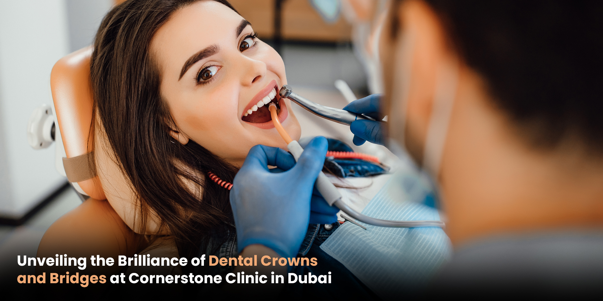 Unveiling the Brilliance of Dental Crowns and Bridges at Cornerstone Clinic in Dubai