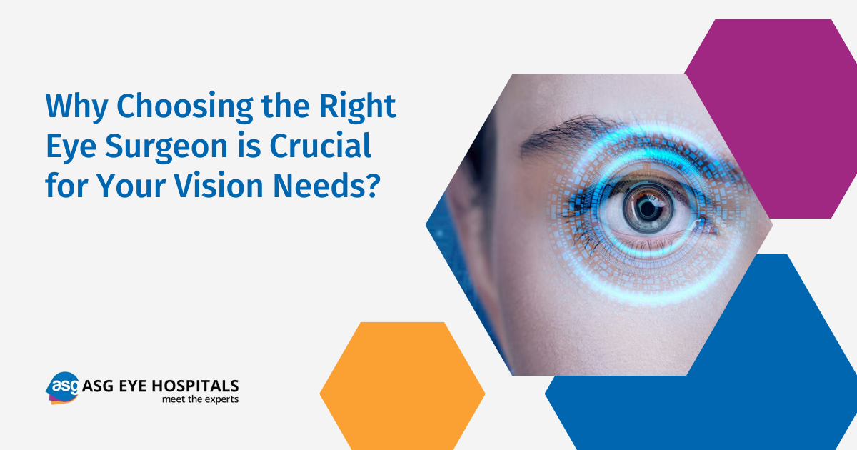 How to Find the Right Eye Surgeon for Your Vision Needs