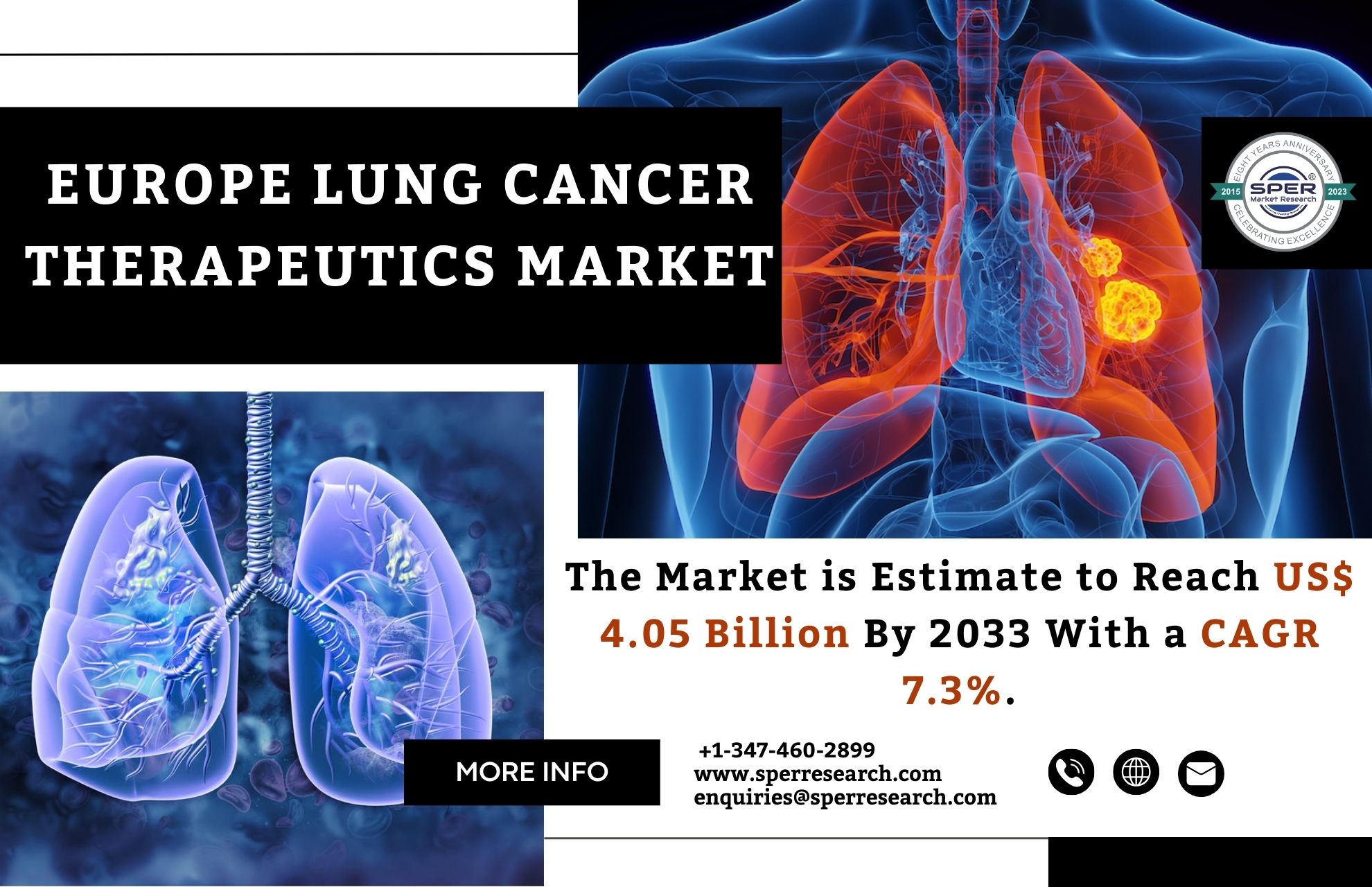 Europe Lung Cancer Therapeutics Market Trends 2024- Industry Share, Revenue, Growth Drivers, CAGR Status, Business Challenges, Opportunities and Future Competition till 2033: SPER Market Research 
