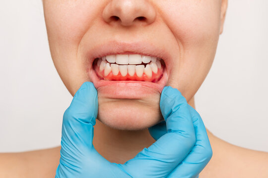 Comprehensive Gum Care for Long-Term Oral Health