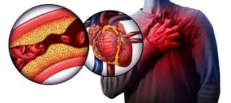 The Integral Role of Medical Oncologists in Treating Hypertension