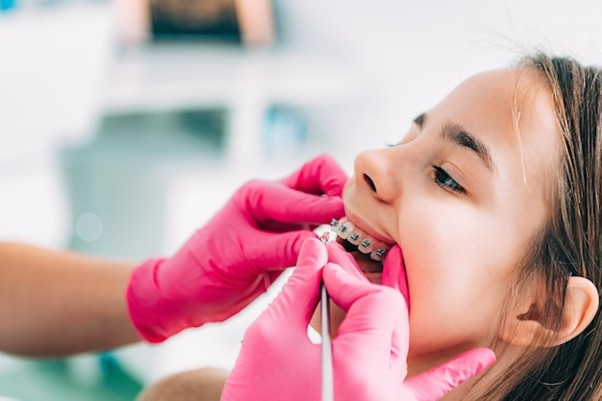 Braces for Kids: When to Start and What Parents Should Know