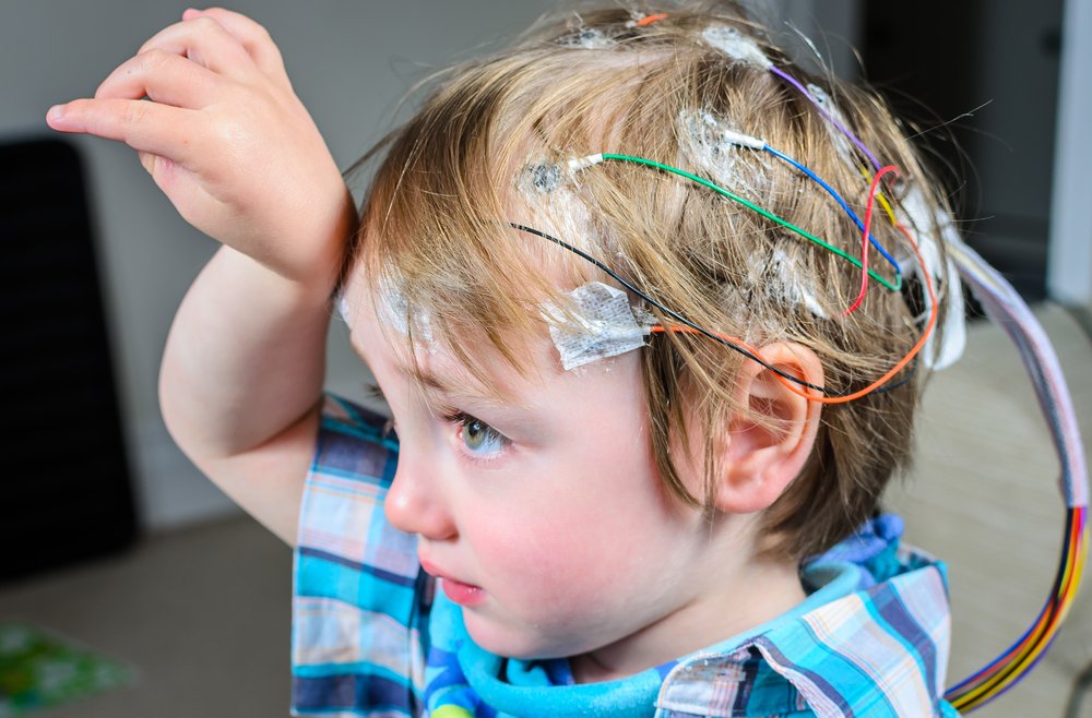 Insights into Childhood Absence Epilepsy Treatment Market: Driving Factors and Strategic Analysis
