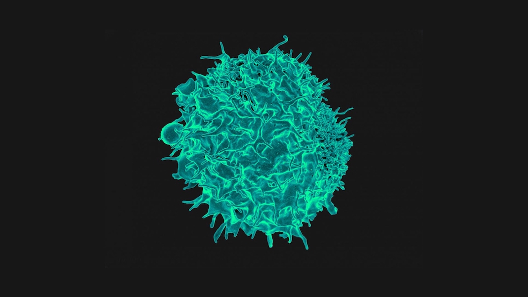 Immune Cell Engineering: Revolutionizing Cancer Immunotherapy