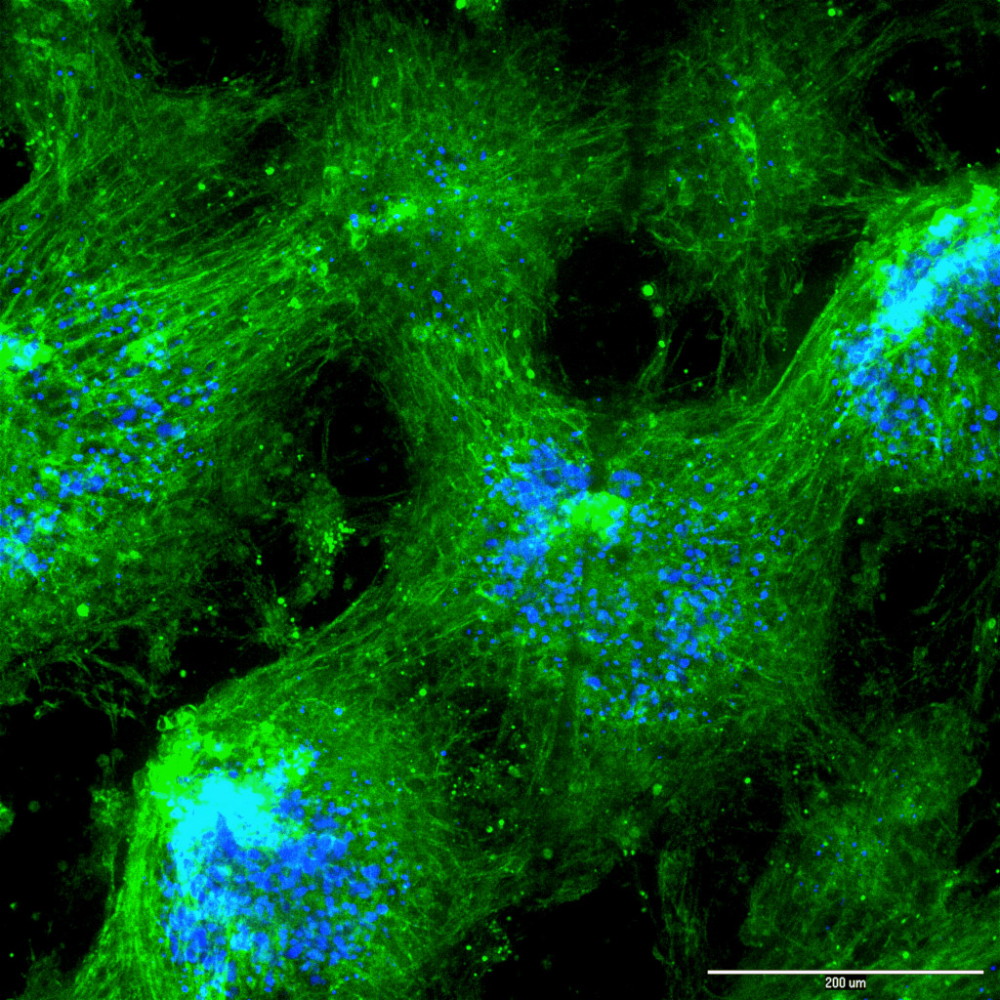 The Architect of Life: Delving into the Intricacies of the Extracellular Matrix