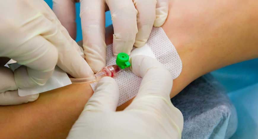 India Vascular Access Devices Market Size, Demand and Global Forecast 2033