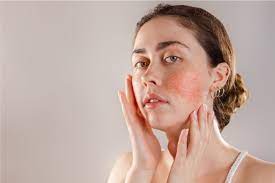 Triluma Cream: Banish Dark Spots, Redness, and Swelling for Radiant Skin