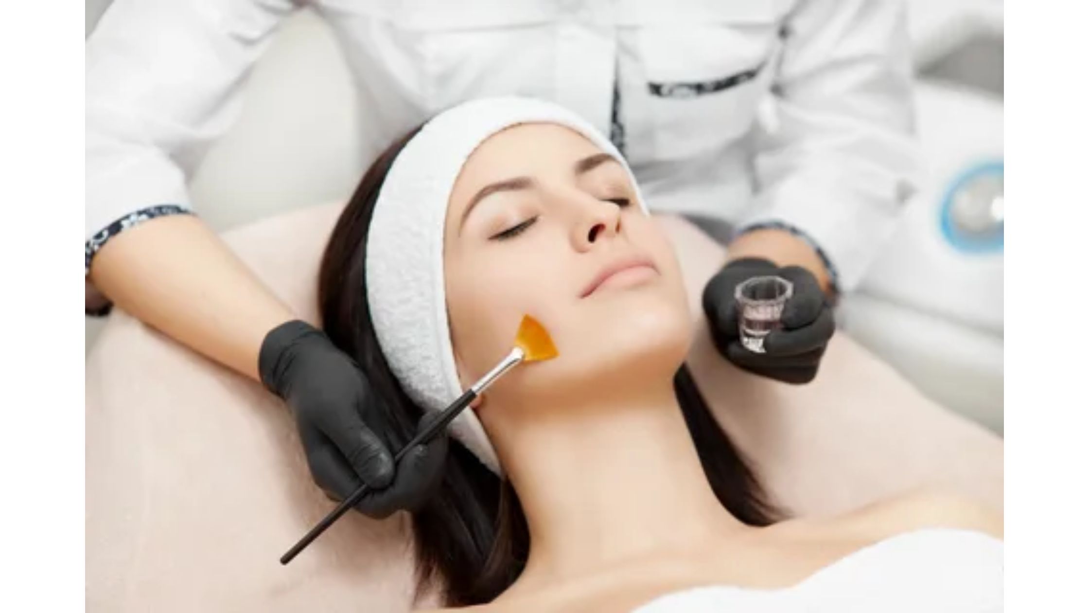 Choosing Excellence: Selecting The Right Chemical Peeling Treatment In Barnesville