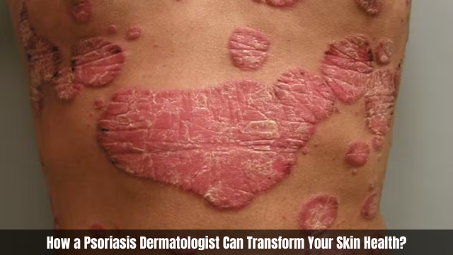 How a Psoriasis Dermatologist Can Transform Your Skin Health?