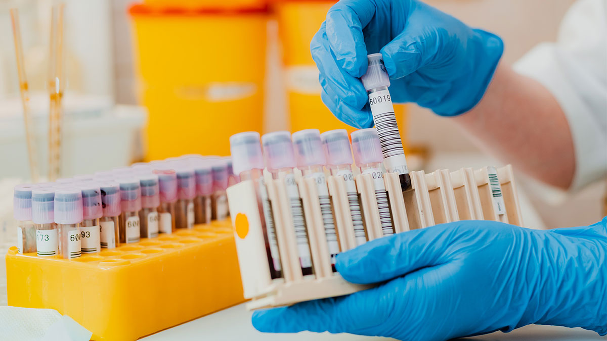 Best diagnostic center in Goregaon, Mumbai | Diagno Lounge