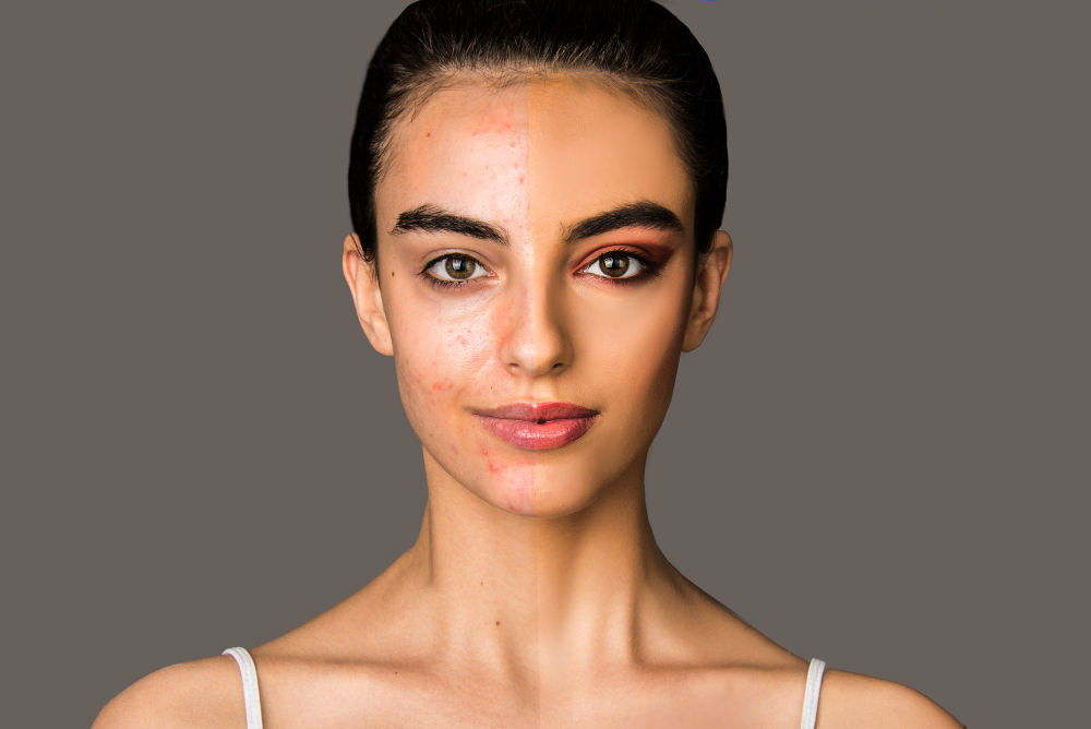 Exploring Cultural Differences in Facial Aesthetics