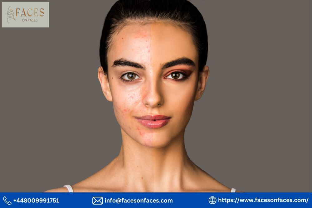 Faces Aesthetics: Your Guide to Facial Beauty