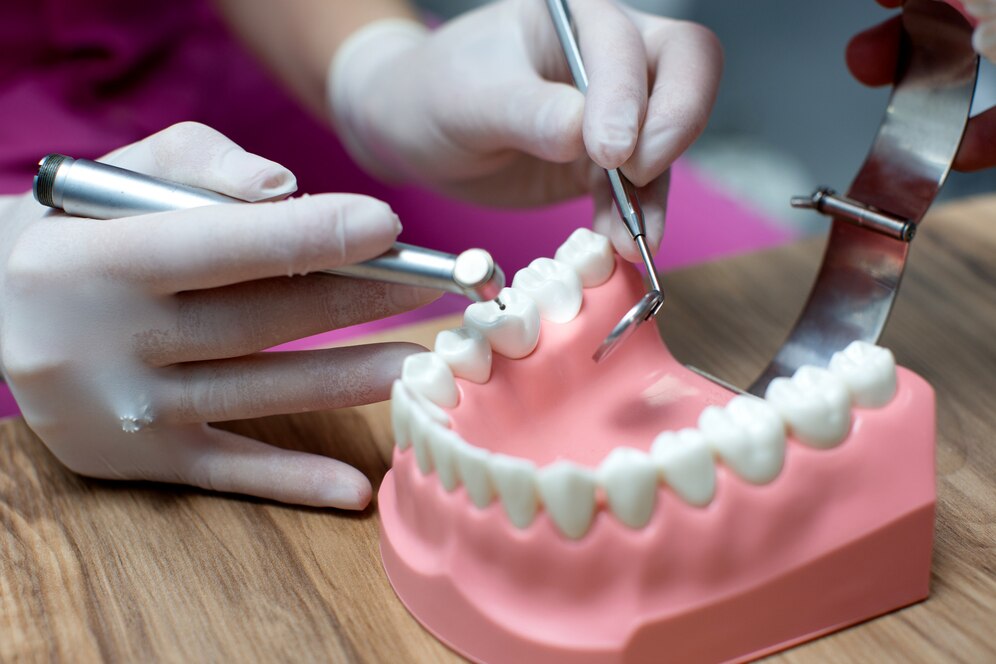 Dental Implants And Prosthetics Market Key Drivers, Insights, Outlook, Overview And Market Research Report 2024-2033