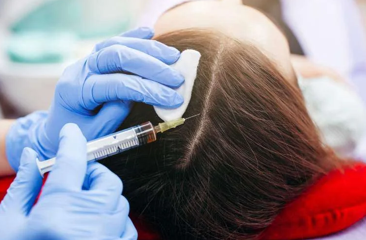 Why Choose PRP Treatment Clinic in Gurgaon for Hair Loss?