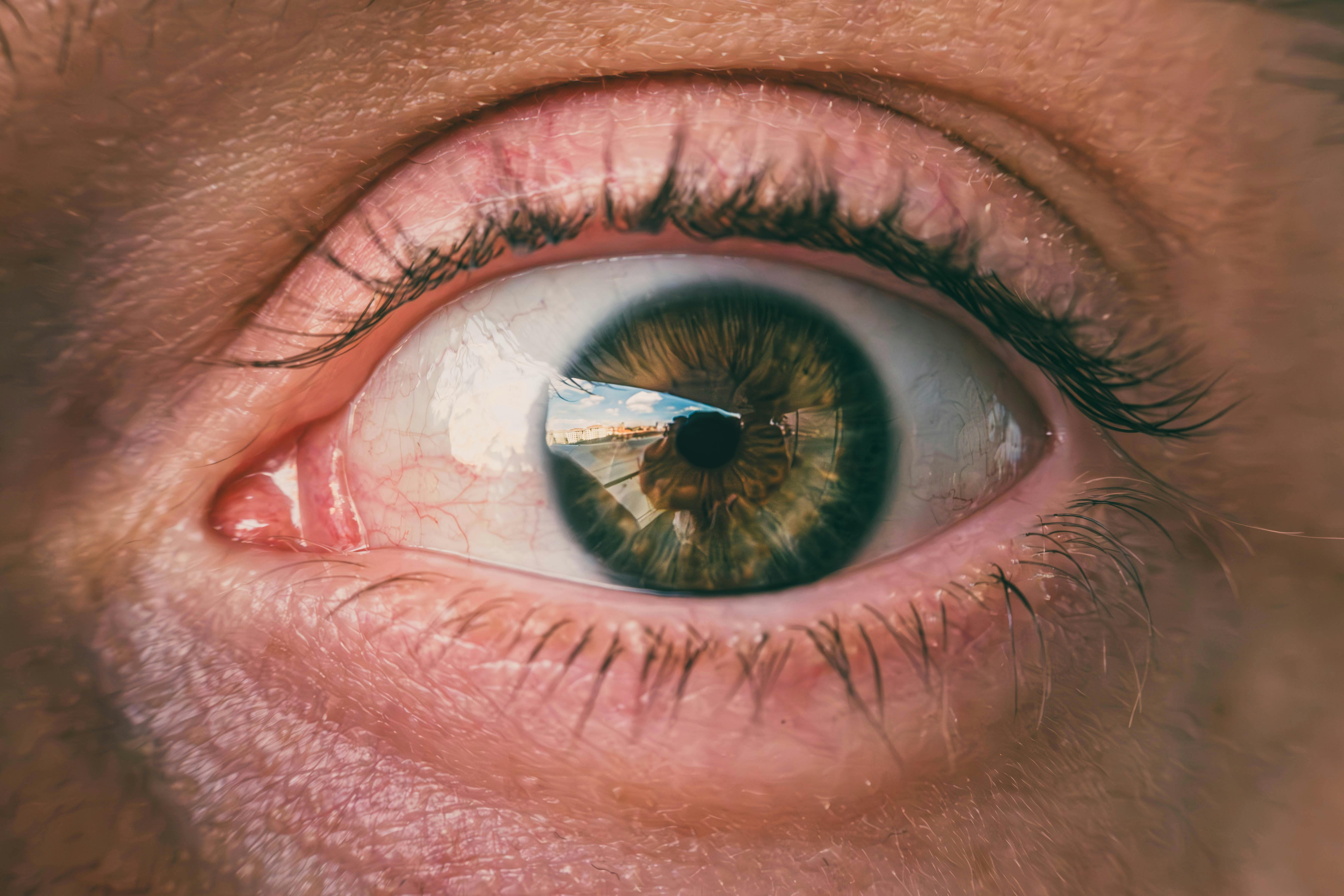 Global Eye Tracking Solutions Market Report 2024: Growth Rate, Major Segments And Regions