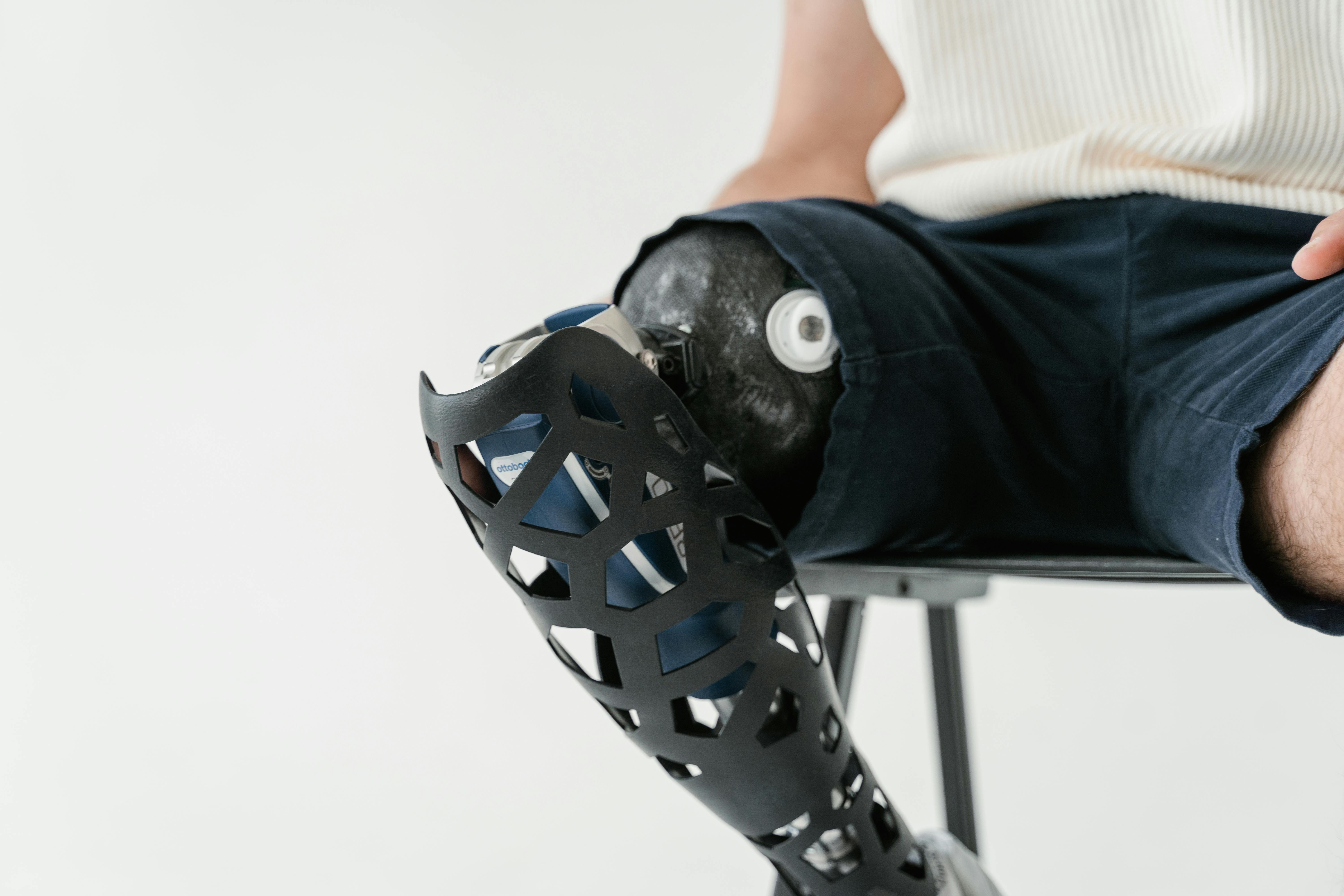 Medical Bionic Implant/Artificial Organs Market Competitve Landscape 2024-2033 – Major Players and Strategies