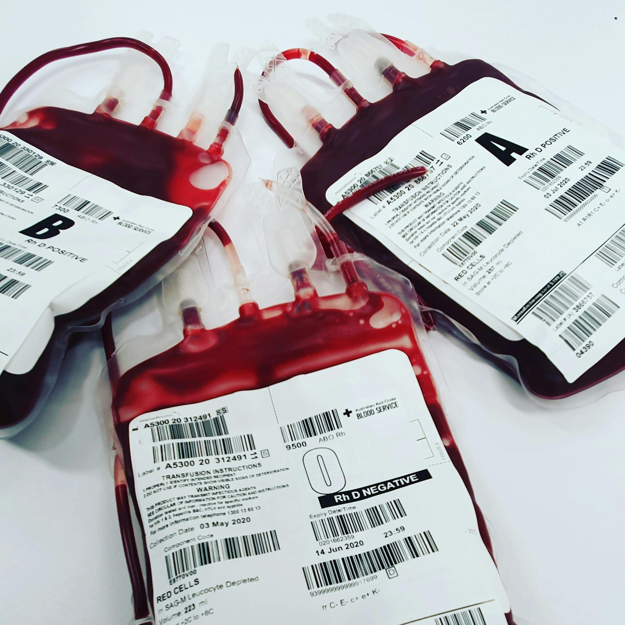 Global Ambulatory IV infusion Pumps Market Report 2024: Growth Rate, Major Segments And Regions