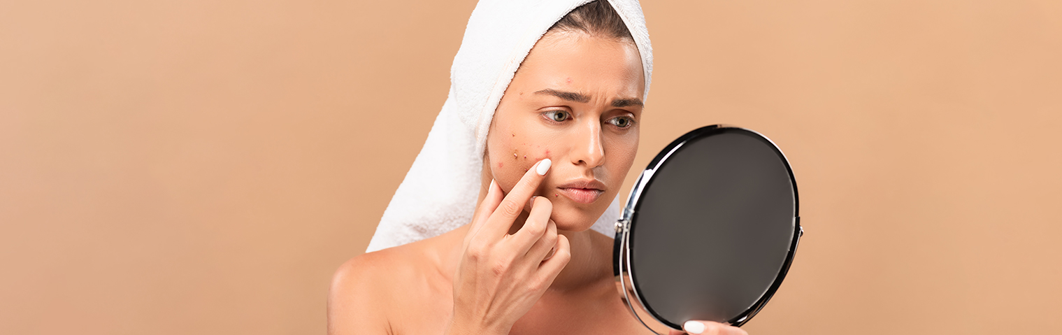 The Causes and Treatment Options for Acne