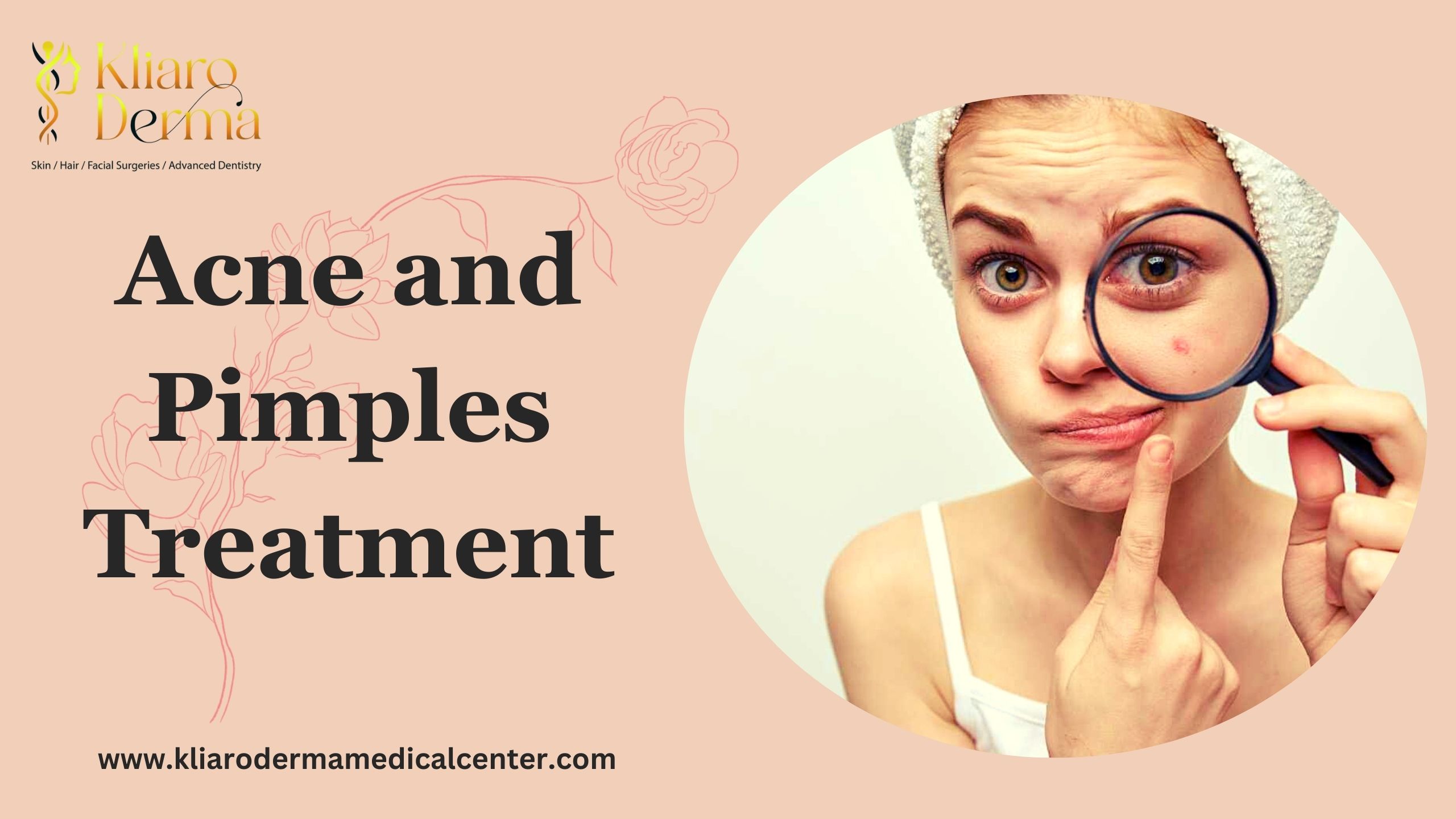 Expert Tips for Choosing the Right Acne Treatment for Your Skin