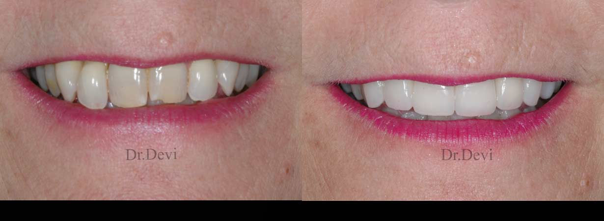 Unveiling Excellence: Your Guide to Cave Creek Dentistry