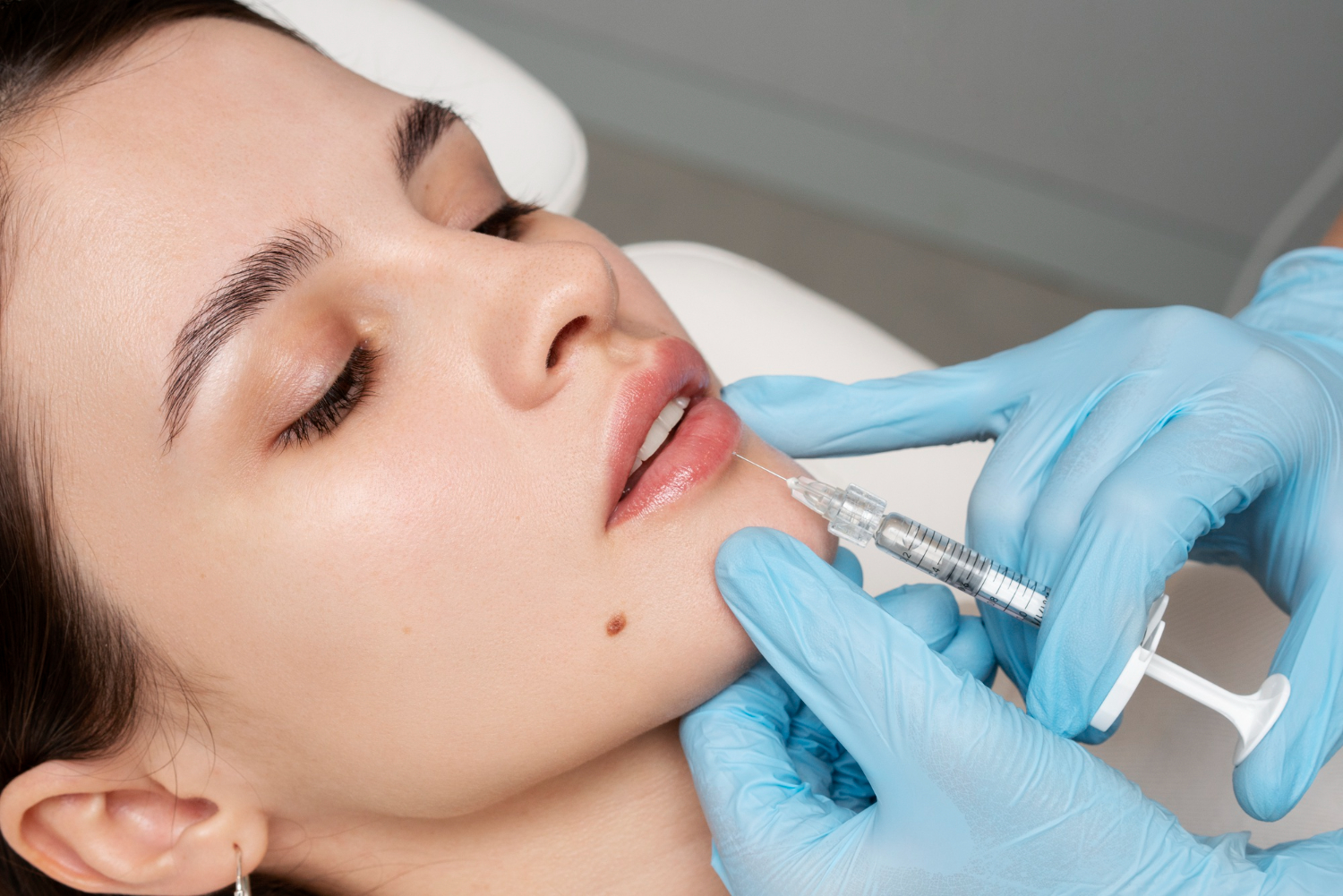 How to Choose the Right Cosmetic Clinic for Your Lip Injections