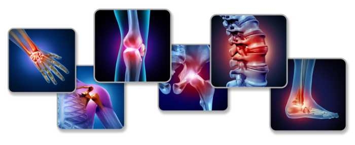 Ayurvedic Treatment for Arthritis in Kerala