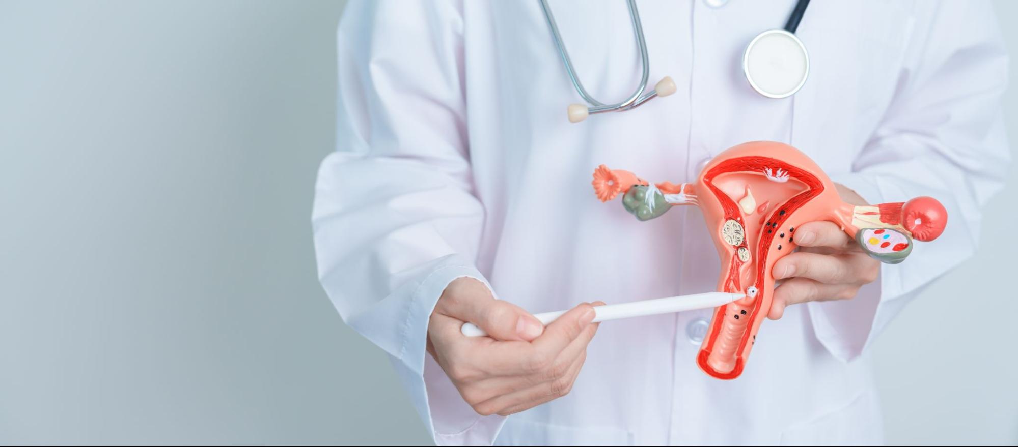 Uterine Fibroid Embolization Device Market Overview 2024-2033 – Competitive Landscape and Strategies