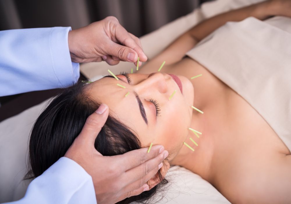 Exploring the Growing Popularity of Cosmetic Acupuncture