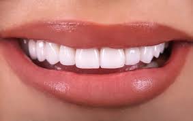 Porcelain Veneers: A Beautiful and Lasting Smile Transformation