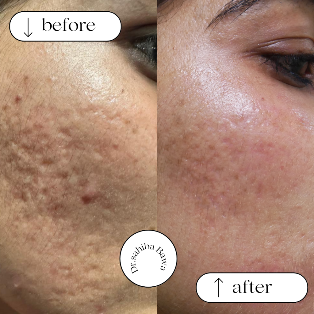 From Acne to Anti-Aging: Services Offered by Aesthetic Skin Clinics