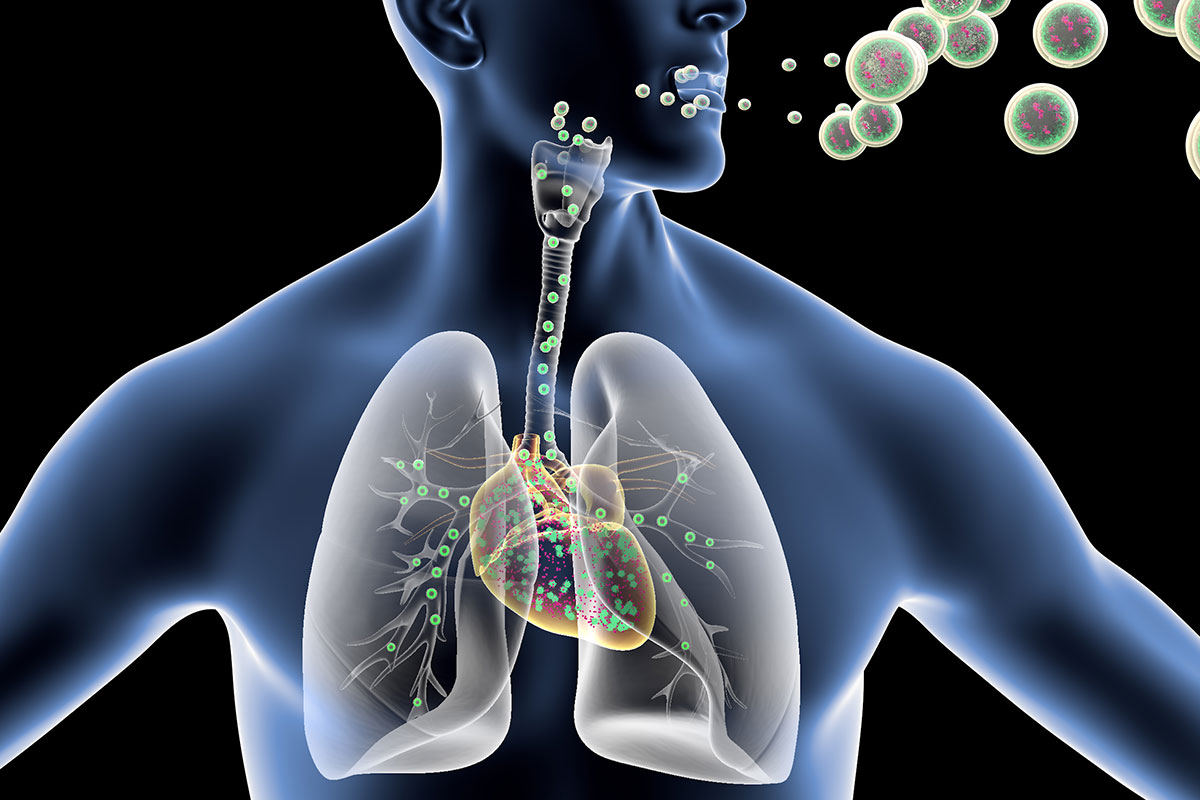 Respiratory Tract Infection Treatment: Understanding, Treating, and Preventing Common  Respiratory Illnesses