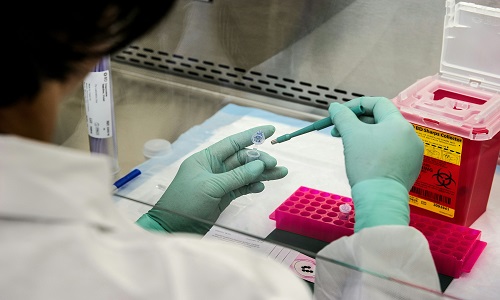 The CILP Protein: A Key Player in Cartilage Health