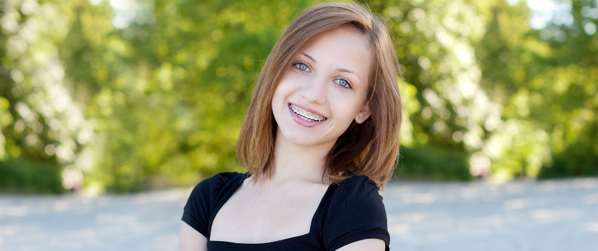 Perfecting Smiles: Finding the Best Braces near Baltimore
