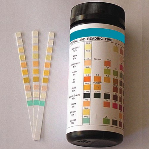 Urine Test Strips Market 2023 Major Key Players and Industry Analysis Till 2032