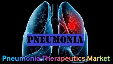 Pneumonia Therapeutics Market 2023 Size, Growth Factors & Forecast Report to 2032