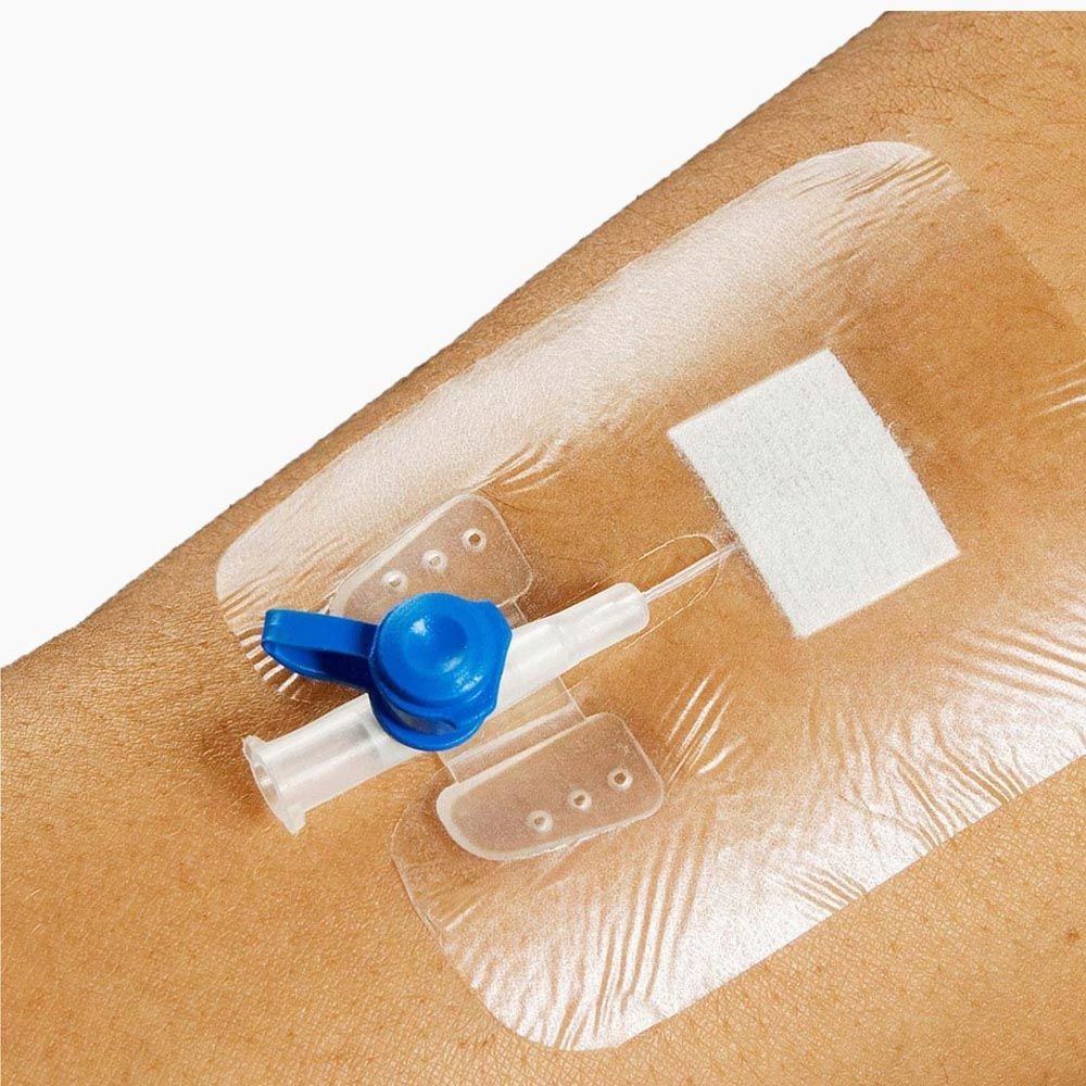 IV Dressing Market 2023 Size, Growth Factors & Forecast Report to 2032