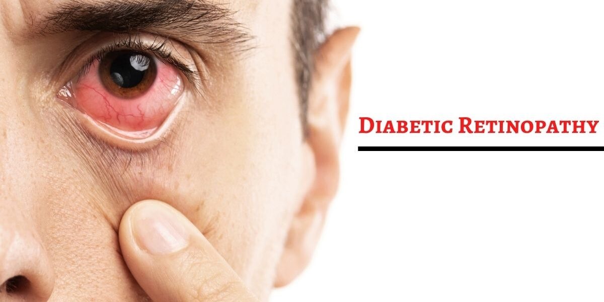 Report on Diabetic Retinopathy Market Research 2032 - Value Market Research