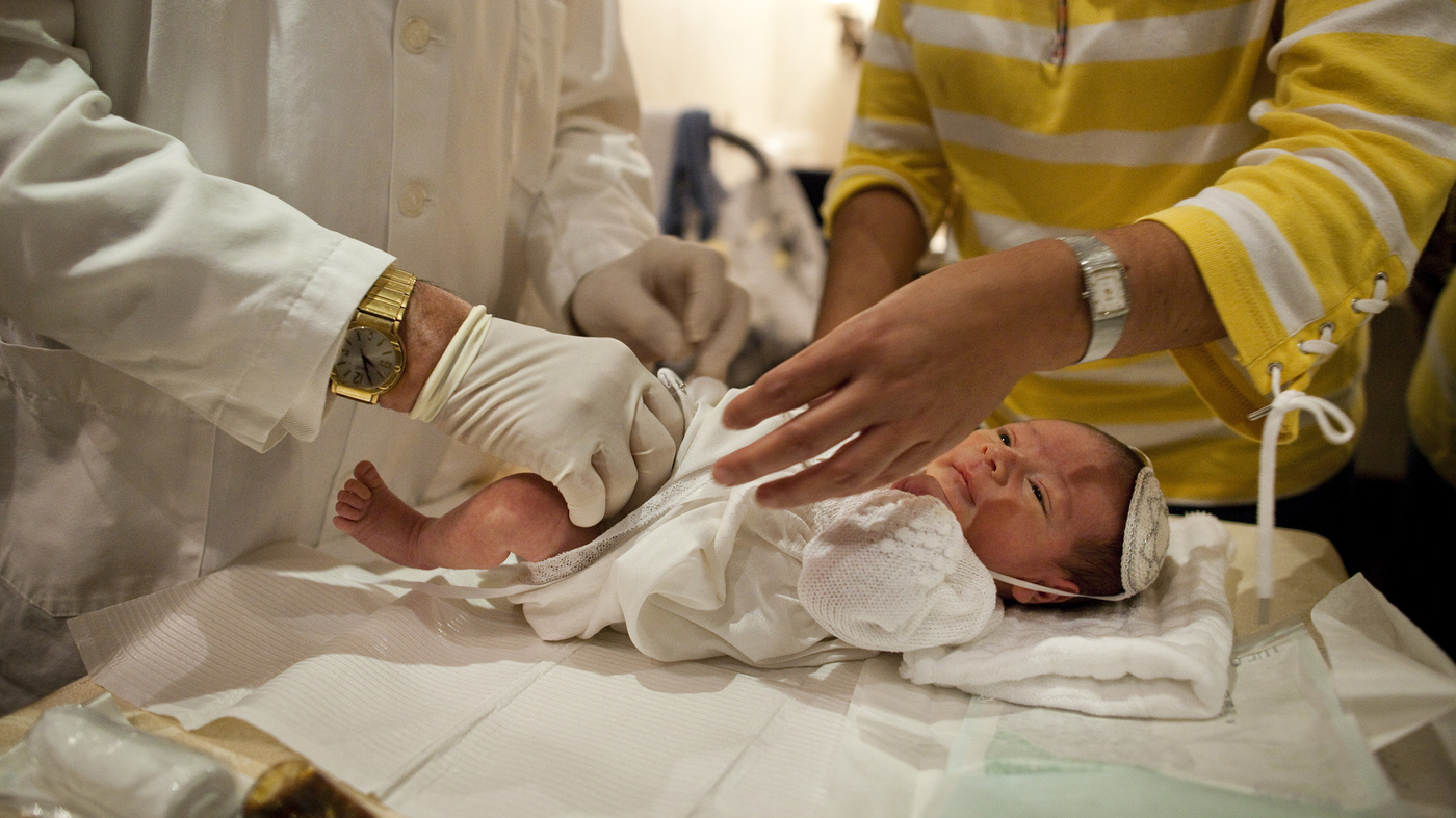 Exploring the Potential Risks and Benefits of Circumcision
