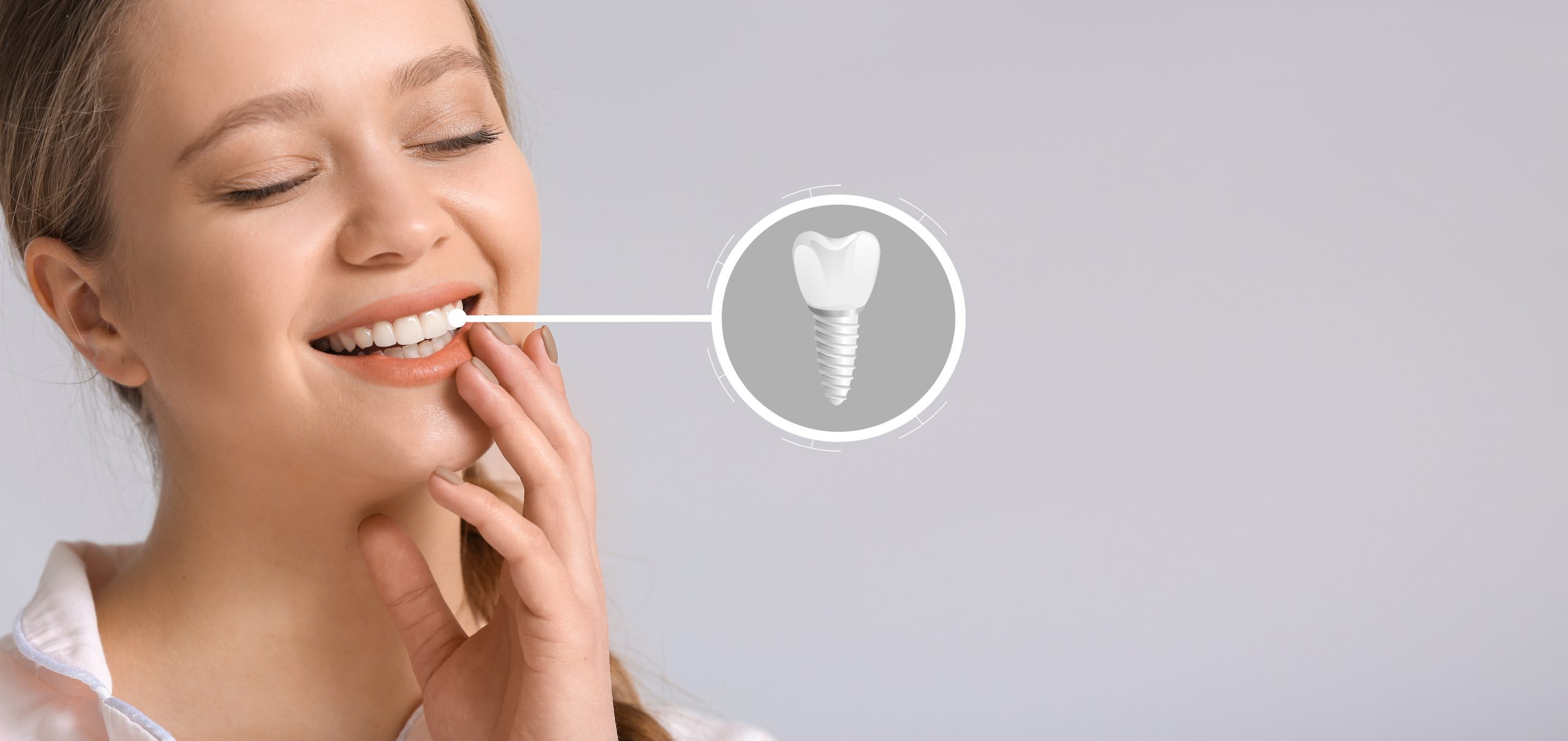 The Importance of Dental Implants