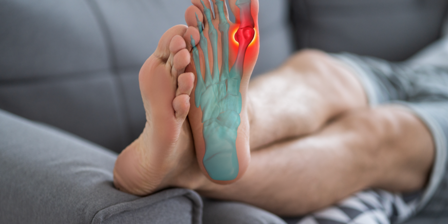 Why is Orthotics The Key to Bursitis Relief and Comfort?