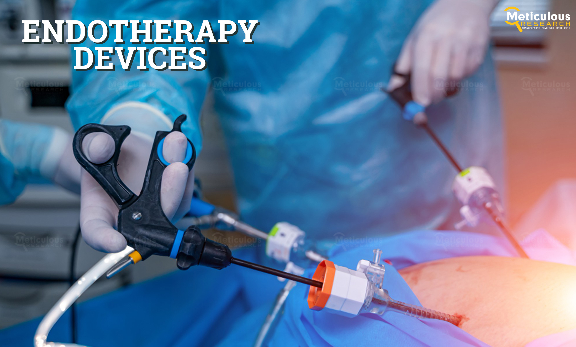 Analysis: Endotherapy Devices Market Set for $7 Billion by 2030