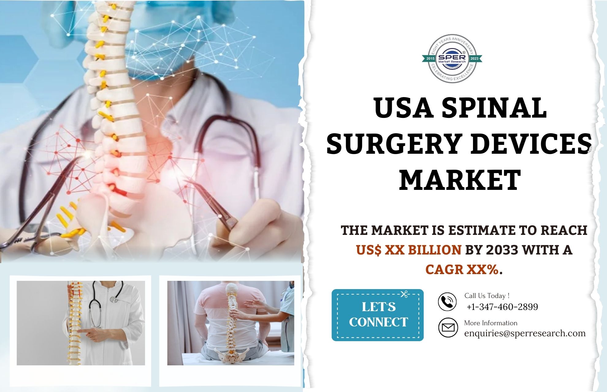 USA Spinal Surgery Devices Market Share 2024- Industry Trends, Revenue, Growth Strategy, Business Challenges and Future Analysis Till 2033: SPER Market Researc