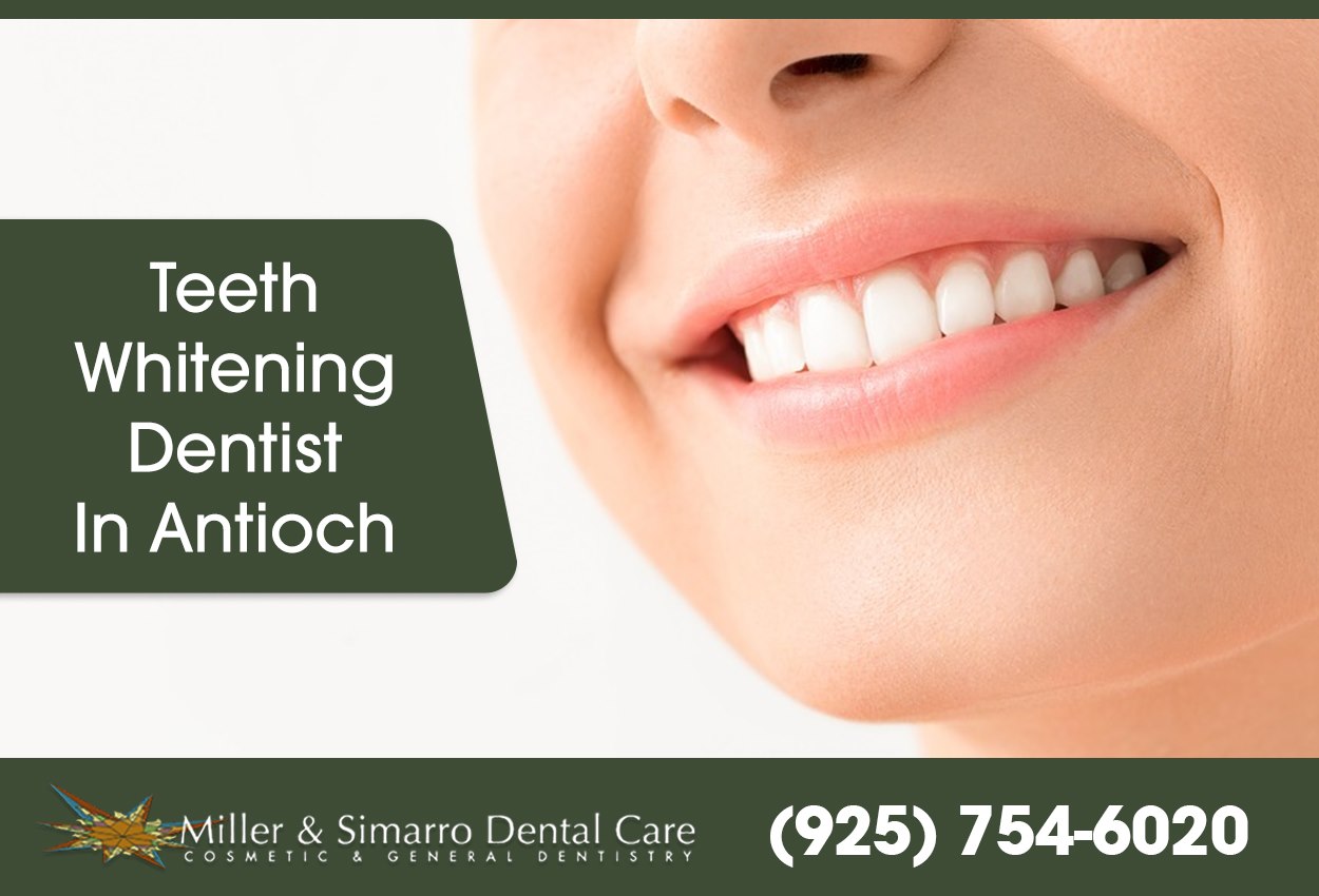Best Teeth Whitening Dentist | Miller and Simarro Dental Care
