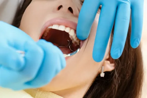 Wisdom Teeth Removal In Parramatta: What You Need To Know