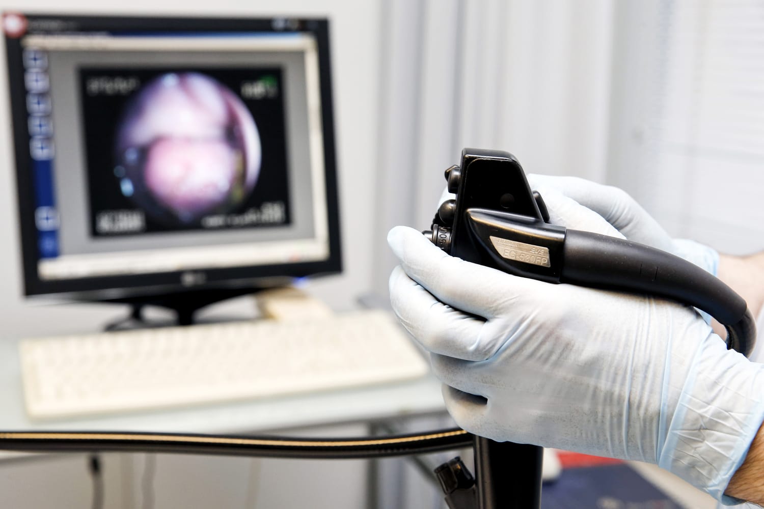 Veterinary Endoscopes Market Analysis Key Trends, Industry Statistics and Forecast 2031