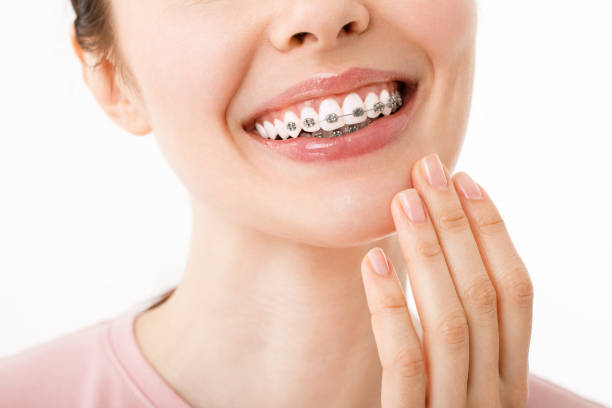 Age and Teeth Straightening: What You Need to Know